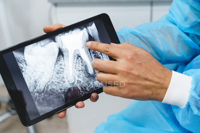 Обрезанный неузнаваемый ортодонт в стерильной униформе, демонстрирующий рентгенографическое изображение на экране планшета во время осмотра в больнице — стоковое фото