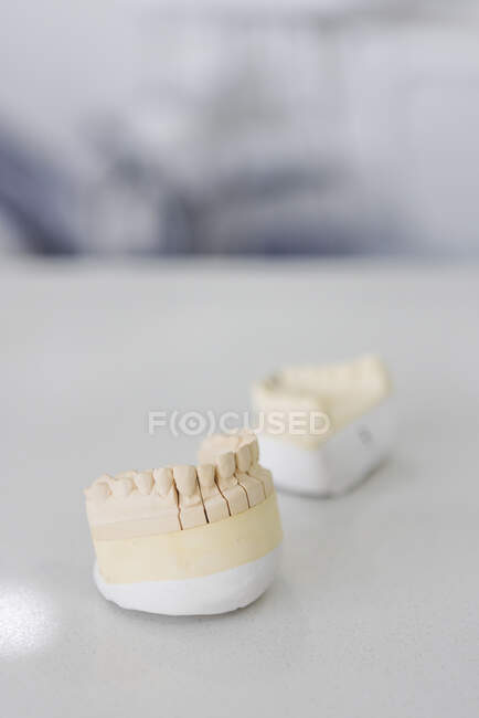 Moldes de mandíbula con dientes falsos hechos de yeso sobre una mesa blanca en el hospital sobre fondo borroso - foto de stock