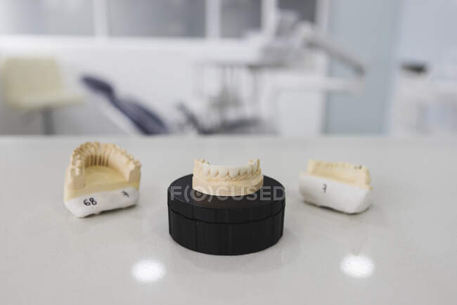 Plaster jaw casts with upper teeth and numbers on desk in clinic on blurred background — Stock Photo
