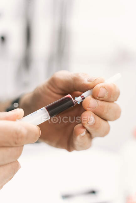 Primer plano médico anónimo con jeringa y tubo con muestra de sangre del paciente para investigación diagnóstica en laboratorio de clínica veterinaria - foto de stock