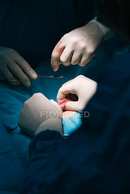 Cosecha anónima veterinaria en guantes de látex con herramientas quirúrgicas haciendo operación en pata de animal cubierto con agujero estéril drapeado en hospital veterinario - foto de stock