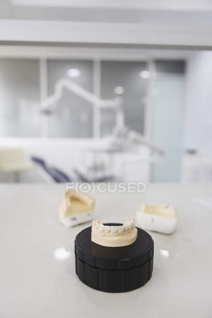 Plaster jaw casts with upper teeth and numbers on desk in clinic on blurred background — Stock Photo