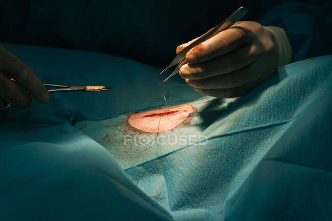 Cirujano veterinario anónimo de cultivo con herramientas profesionales que cortan el hilo después de coser la herida en el paciente animal cubierto con una cortina quirúrgica estéril en el quirófano - foto de stock