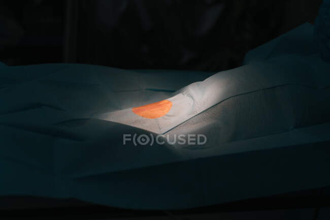 Foco seletivo do campo cirúrgico estéril branco que cobre a pata do paciente do animal de estimação antes da cirurgia na sala de cirurgia — Fotografia de Stock