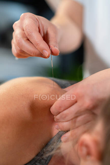 Unrecognizable physiotherapist inserting needle into shoulder of relaxed female patient during acupuncture session in clinic — Stock Photo