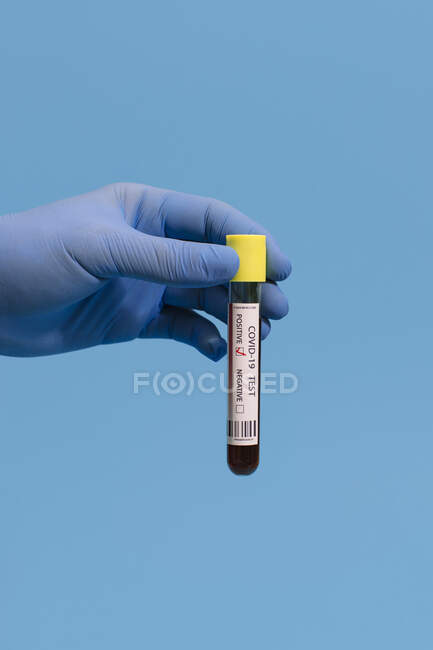 Beschnittene, unkenntlich gemachte Arzthand mit positivem Coronavirus-Bluttest vor rosa Hintergrund — Stockfoto