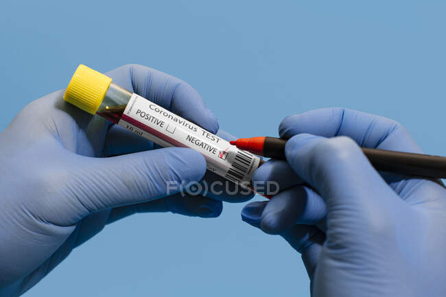 Ausgeschnittene, unkenntlich gemachte Arzthand, die mit Stift einen negativen Bluttest auf Coronavirus vor rosa Hintergrund zeigt und macht — Stockfoto