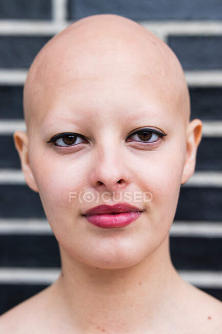 Calma joven calva modelo femenino con alopecia enfermedad autoinmune mirando a la cámara contra la pared de ladrillo negro a la luz del día - foto de stock