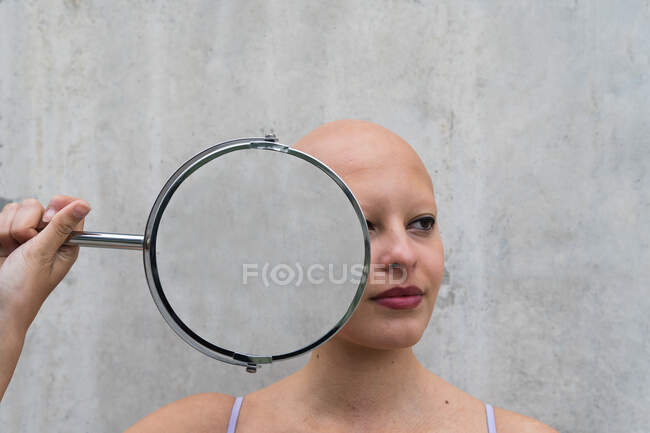 Giovane femmina calva con alopecia malattia autoimmune tenendo rotondo specchio sagomato vicino al viso mostrando riflesso diverso — Foto stock