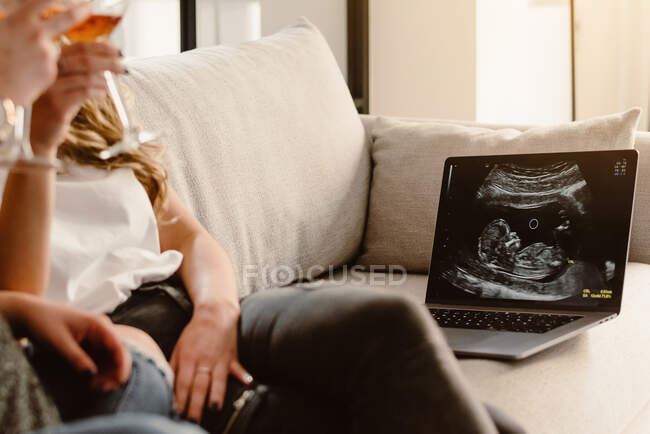 Crop anonymous lesbian couple clinking glasses while celebrating pregnancy and sitting on sofa with laptop showing ultrasound scan — Stock Photo