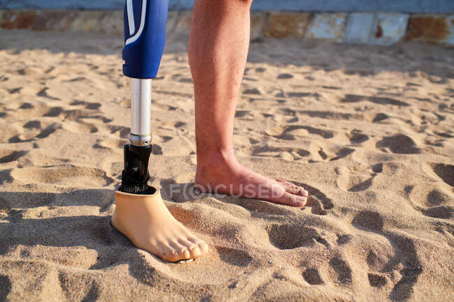 Close-up de homem irreconhecível com prótese de perna em pé na praia de areia em dia ensolarado — Fotografia de Stock
