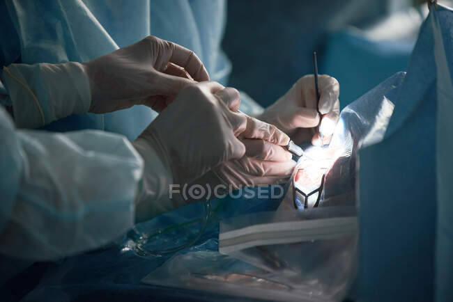 Crop unrecognizable surgeon with coworker in uniform operating eye of patient on bed in hospital — Stock Photo