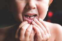 Petit garçon perdant sa première dent — Photo de stock