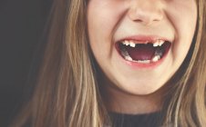 Розрив зубної дівчини сміється — стокове фото