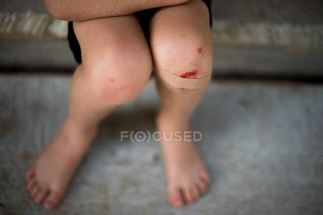 Мальчик сидит на ступеньке с прилипшей штукатуркой на колене — стоковое фото