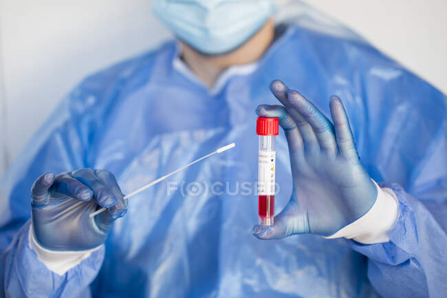 Primer plano de un médico listo para realizar una prueba de PCR - foto de stock