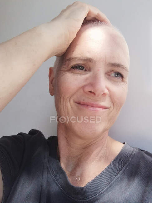 Portrait of a bald woman with cancer her hand her head — Stock Photo