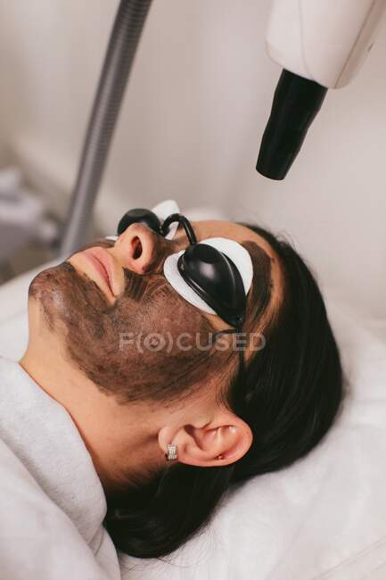 Woman having a carbon peel beauty treatment — Stock Photo