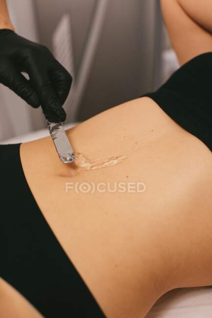 Woman having gel applied for a Laser hair removal treatment in a beauty salon — Stock Photo